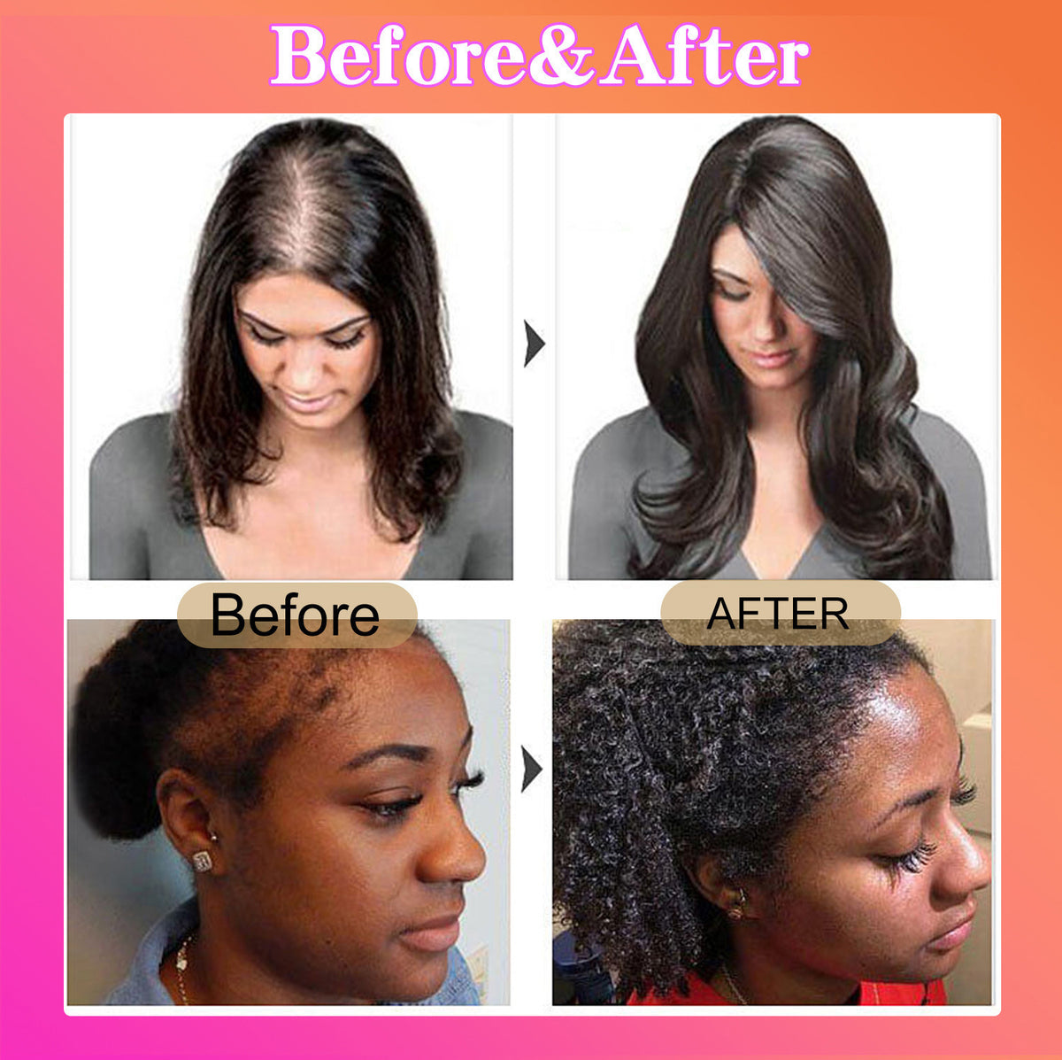 Batana Oil for Hair Growth Hair Conditioner Moisturizing and Repairing